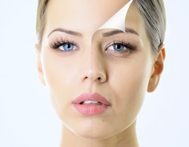 ZL Medspa Blog | 10 Things to Know Before Getting a Peel